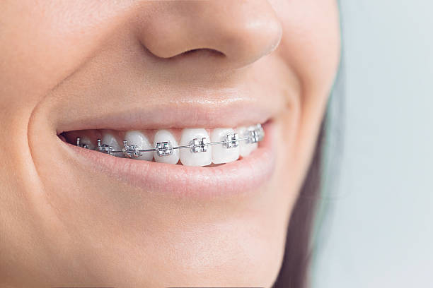 Best Traditional Braces  in Surfside, FL